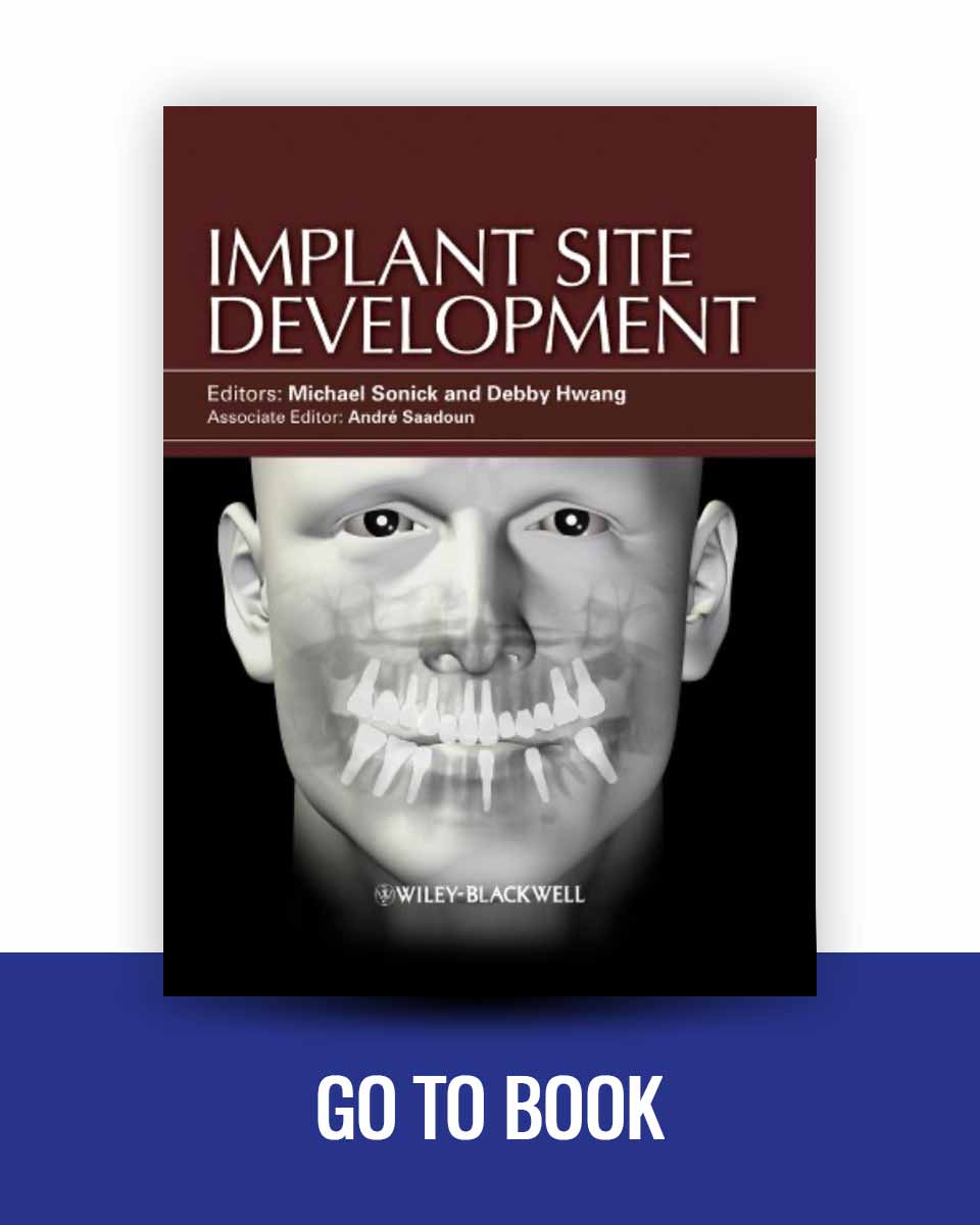 Implant Site Development