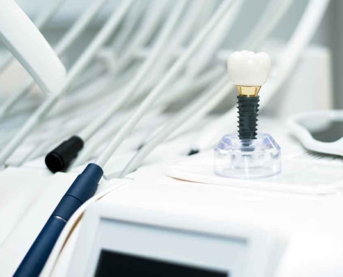 What Happens at Your All-on-4 Maintenance Appointment