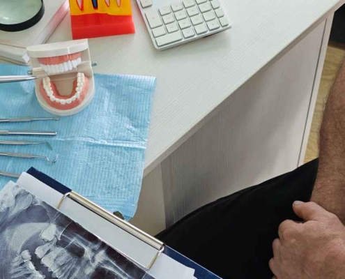 how the all-on-4 treatment is planned: from consultation to digital surgery