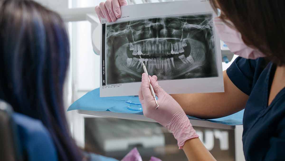 Root Canal or Dental Implant How to Know Which Treatment Is Right for